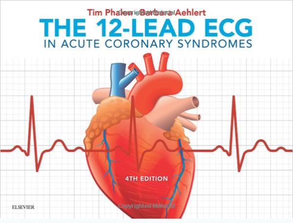 The 12-Lead ECG in Acute Coronary Syndromes - Image 2